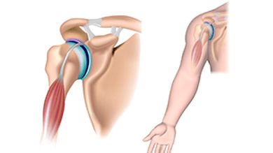 How can you accommodate employees with musculoskeletal conditions? - Post Thumbnail