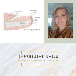 Winner Supplied Image - Impressive Nails